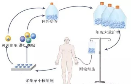 DC-CIK生物免疫療法治療腫瘤的優(yōu)勢(shì)作用詳解